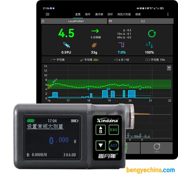 鑫丹娜閉環(huán)胰島素泵